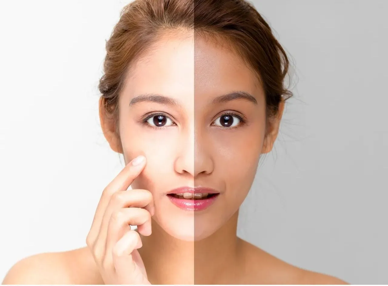 معرفی ۷ مدل از بهترین کرم های سفید کننده صورت و بدن خارجی