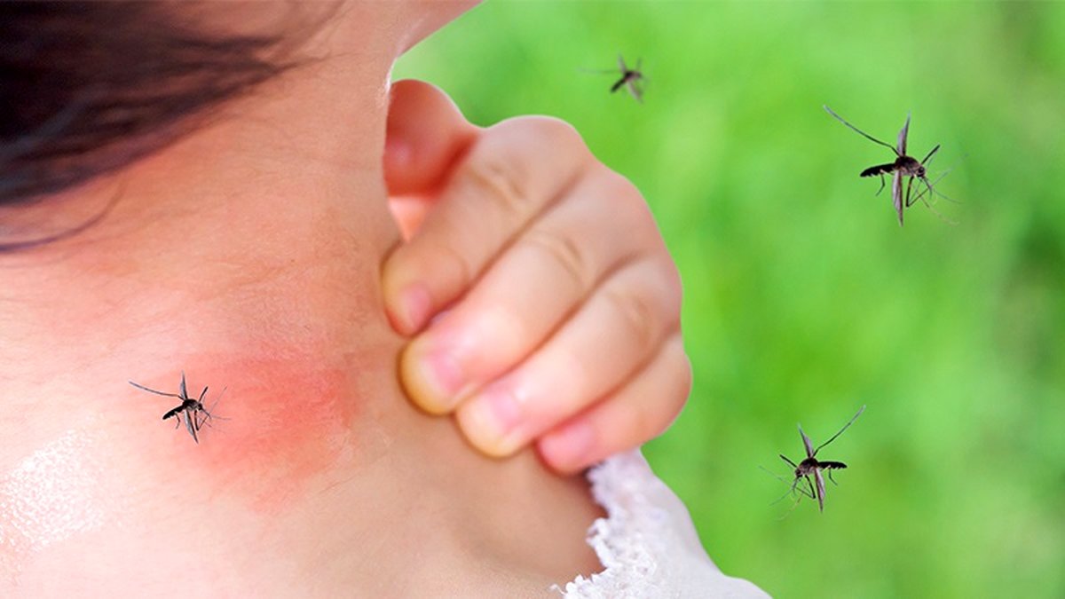 7 ترفند از بین بردن پشه و حشرات موزی در منزل